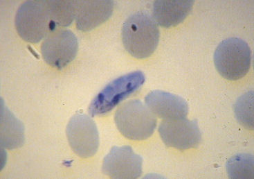 P.falciparum-gametocyte